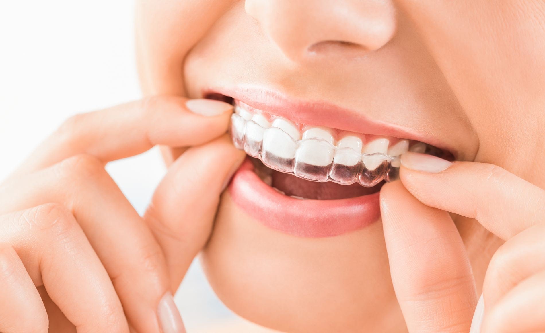 smile-studio-dentist-penarth-0004-1.jpg