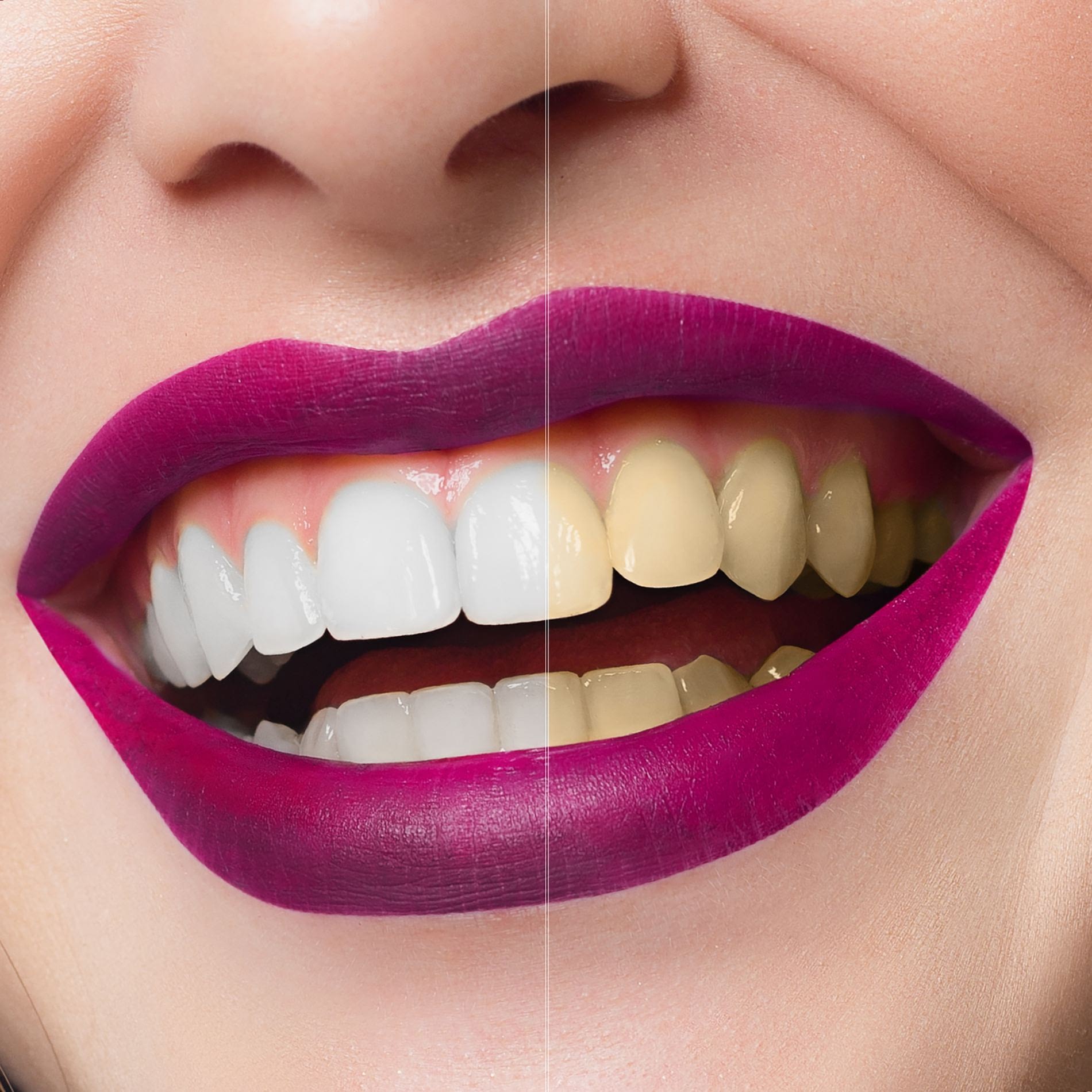 smile-studio-dentist-penarth-0008-1.jpg