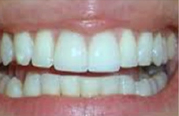 White After