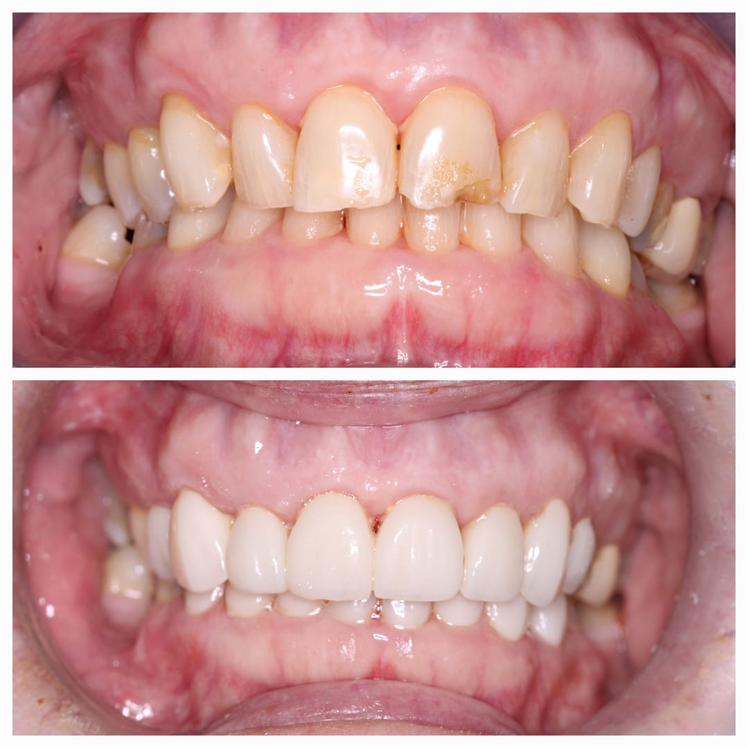 jd before and after