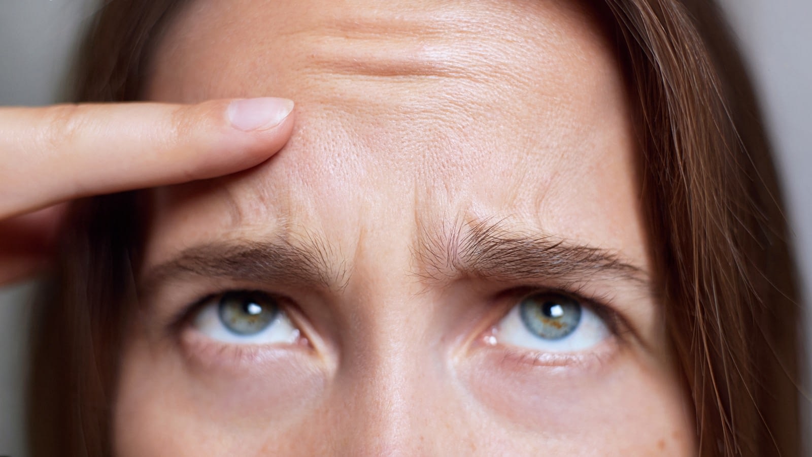 facial line treatments