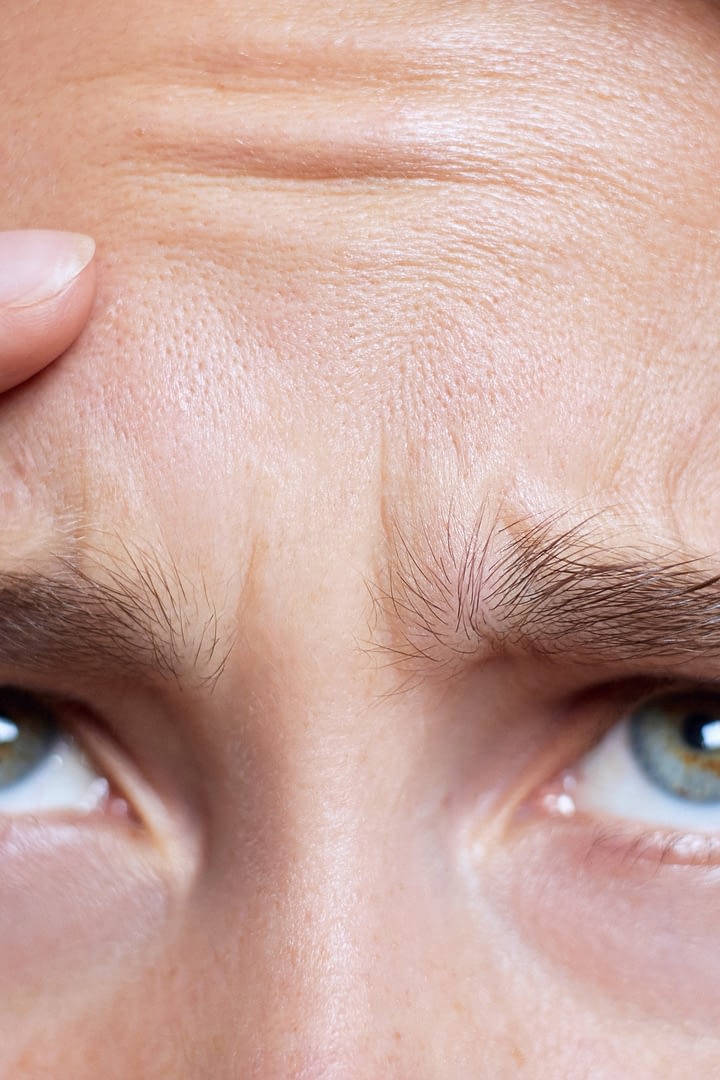 facial line treatments — treatment facial line treatments — treatment
