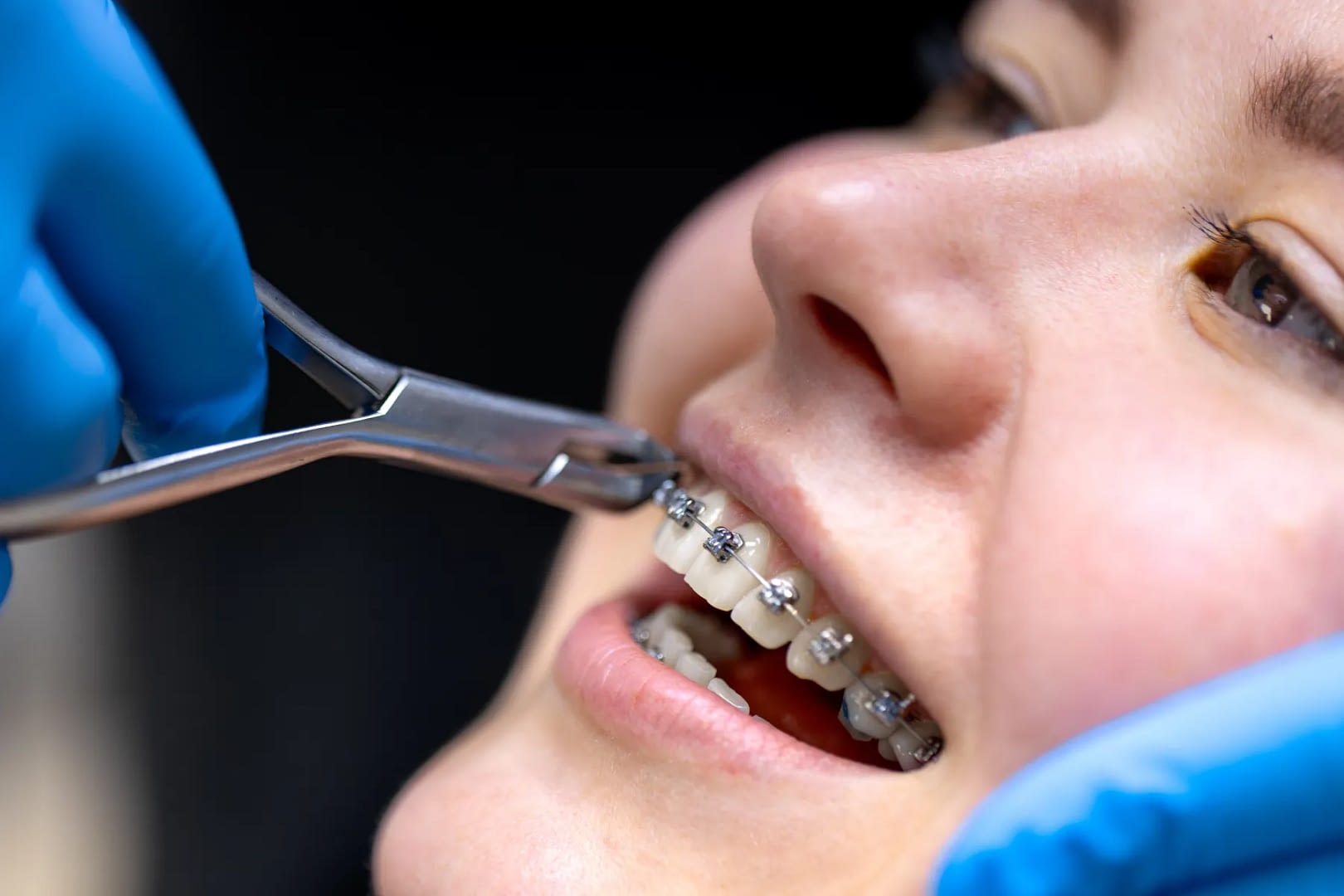 orthodontics penarth