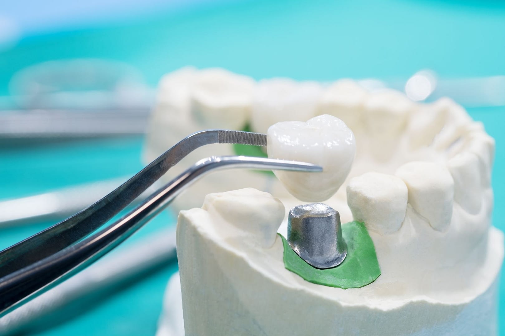 Smile Studio Dentist Penarth 0005