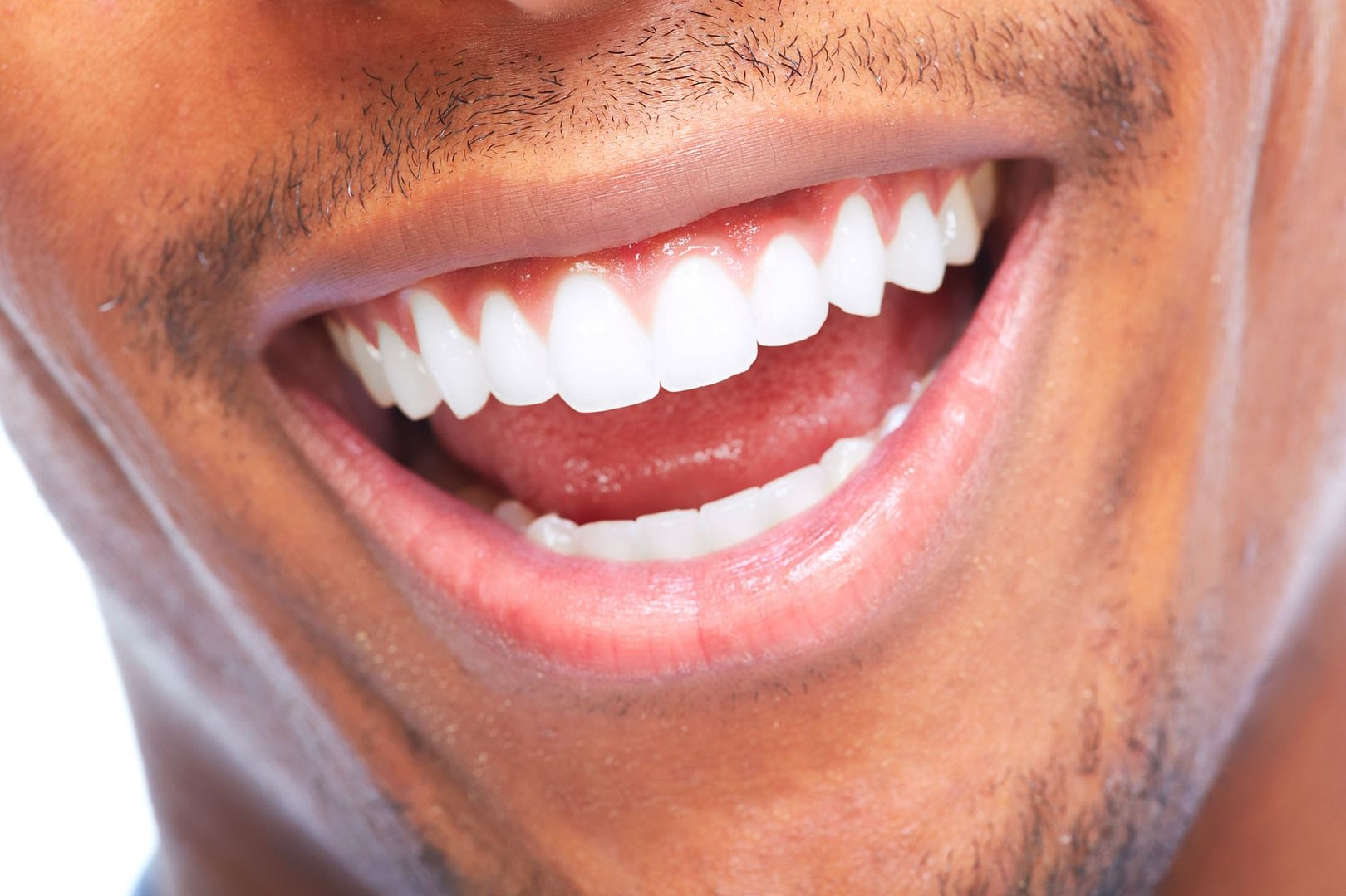 Smile Studio Dentist Penarth 02