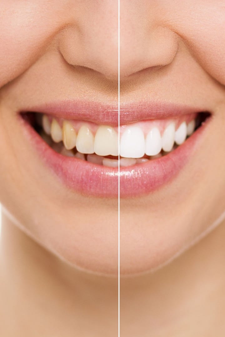 hywel samuel golate cardiff dental clinic 2999 hywel samuel golate cardiff dental clinic 2999