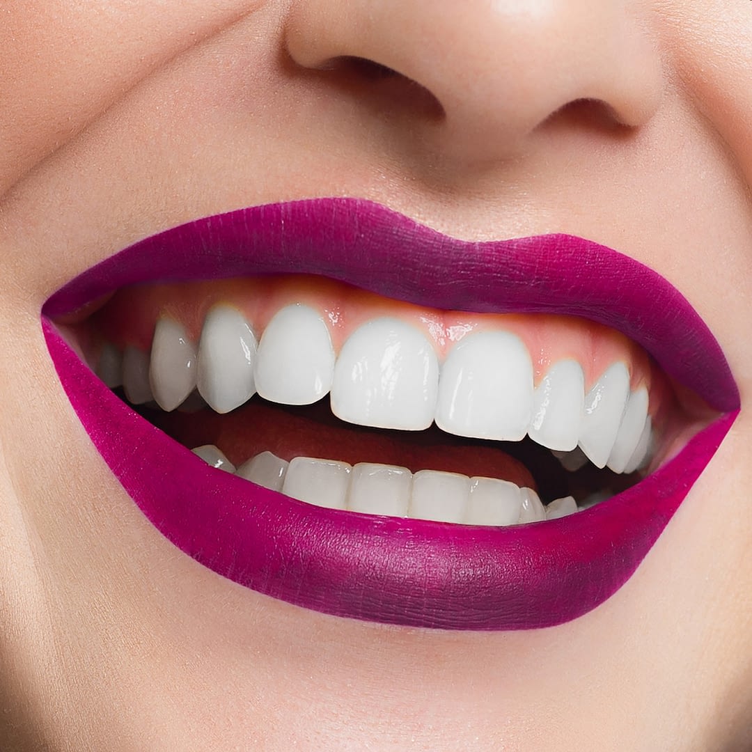 Smile Studio Penarth White Teeth