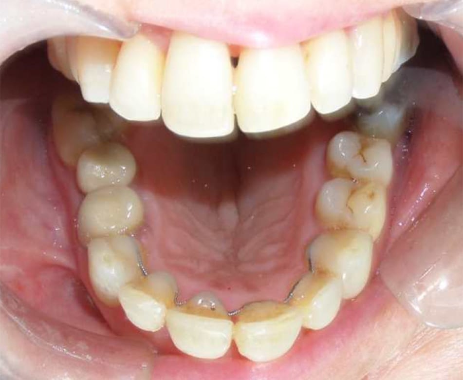 Afters Orthodontics Penarth